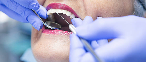 Best Emergency Dental Extractions in Badin, NC